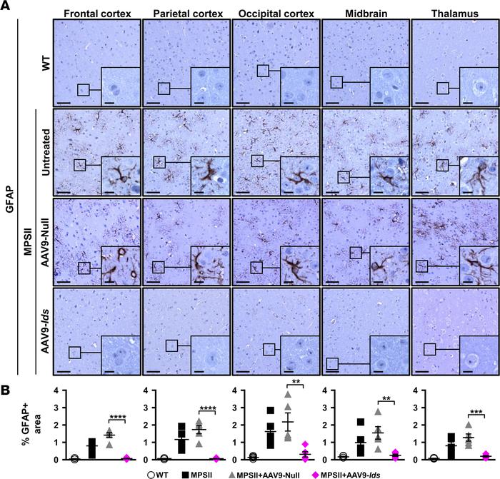 
						Intra-CSF gene therapy with AAV9-
						Ids
						 corrects astro...