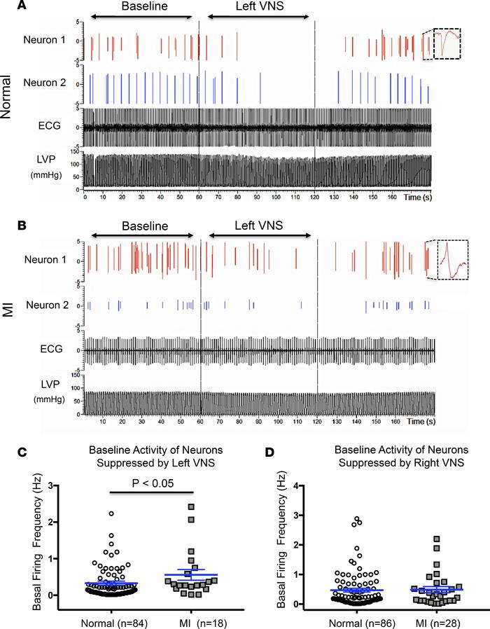 Recordings from cardiac neurons that are suppressed by VNS.
(A) Example ...