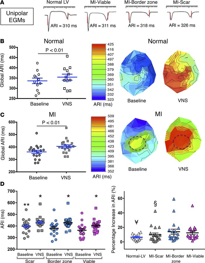 Electrophysiological response to VNS.
(A) Examples of unipolar electrogr...