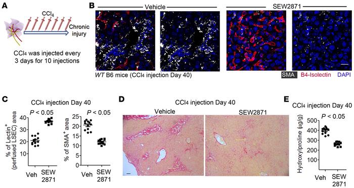 SEW2871 decreases liver fibrosis in WT mice after repetitive injection o...