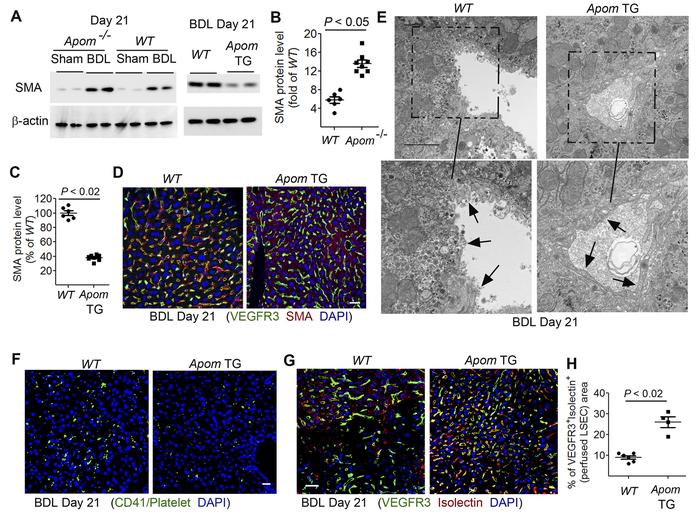 Fibrosis and vascular structure in WT, Apom-/-, and Apom TG mouse liver ...