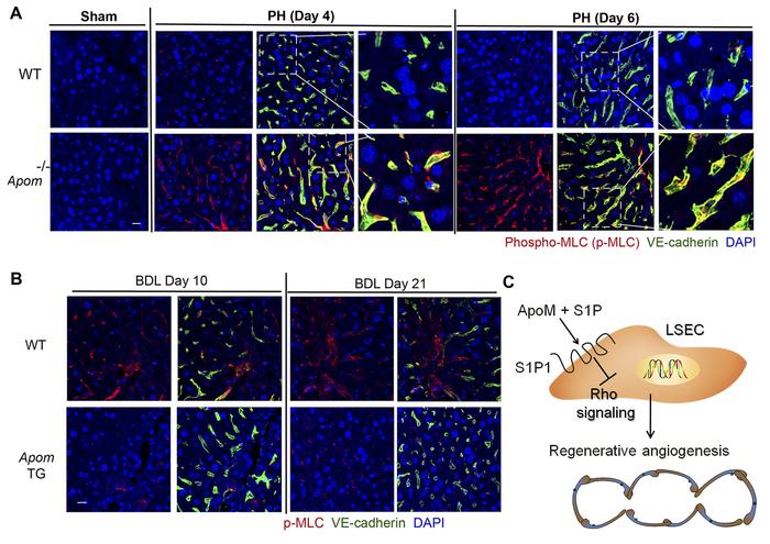 ApoM-S1P1 pathway prevents Rho activation in mouse LSEC after PH and BDL...