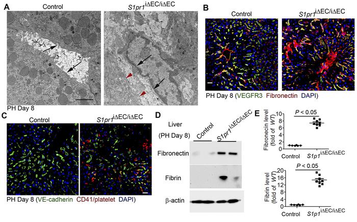 Development of fibrosis in hepatectomized S1pr1iΔEC/iΔEC mice.
(A and B)...