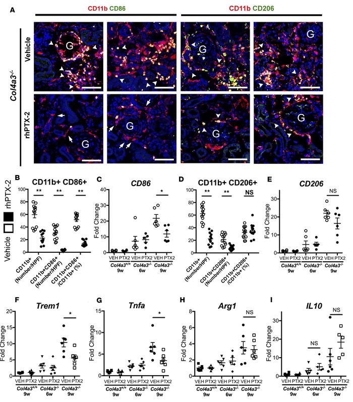 rhPTX-2 reduces the population of M1-type activated macrophages in Col4a...