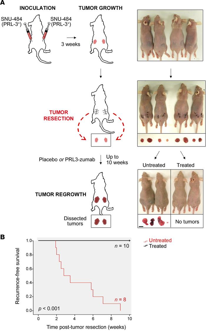 PRL3-zumab prevents PRL-3+ tumor recurrence and prolongs survival after ...