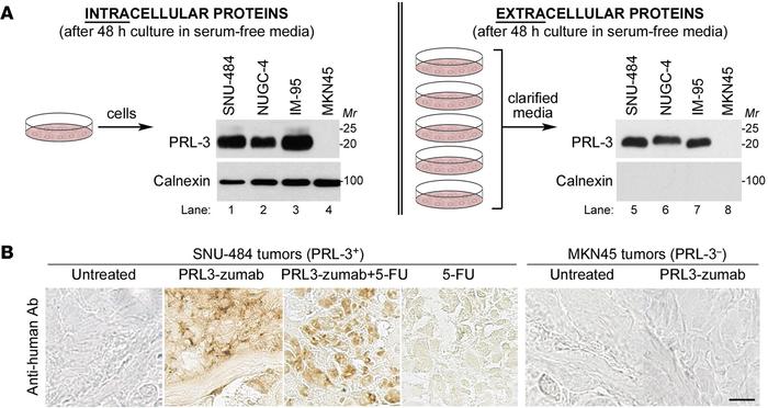 PRL-3 oncoprotein may be secreted out of cancer cells and act as bait fo...