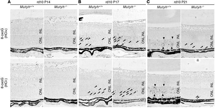 
Mutyh deficiency suppressed the expansion of retinal oxidative DNA dama...