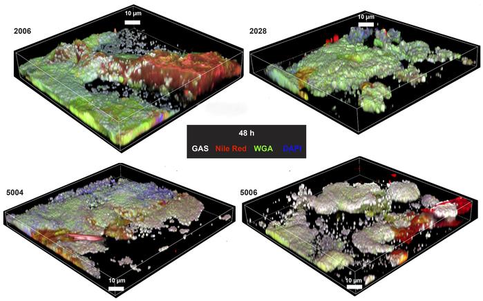 Biofilm formation in skin tissue models infected with group A streptococ...