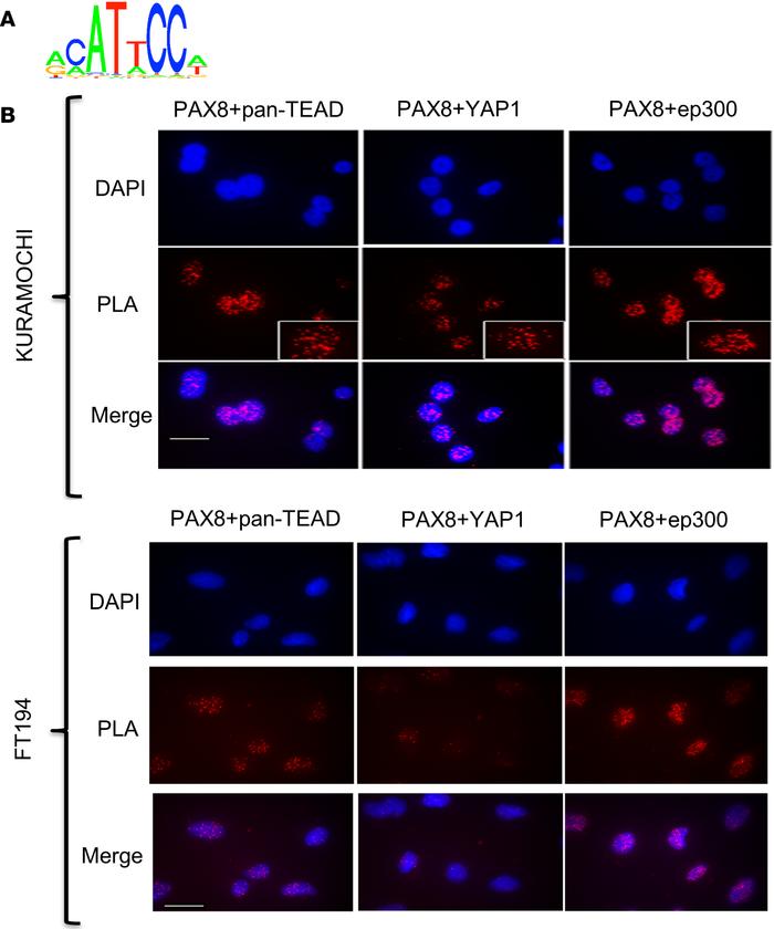 Interaction between PAX8 and TEAD/YAP1.
(A) Most common secondary motif ...