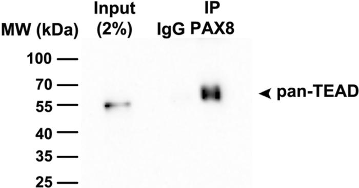 Confirmation of a PAX8-TEAD interaction.
Immunoprecipitation of KURAMOCH...
