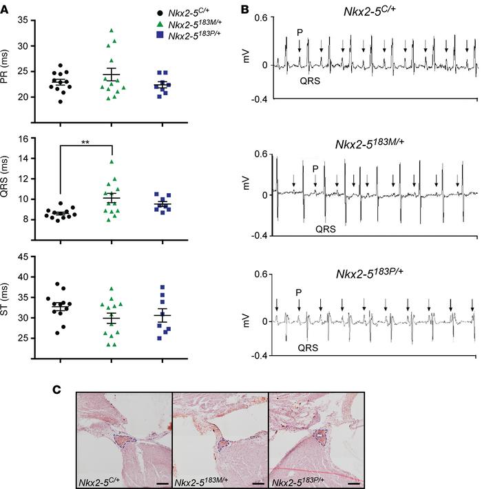 Electrical disturbances detected in heterozygous Nkx2-5 mice.
(A and B)....