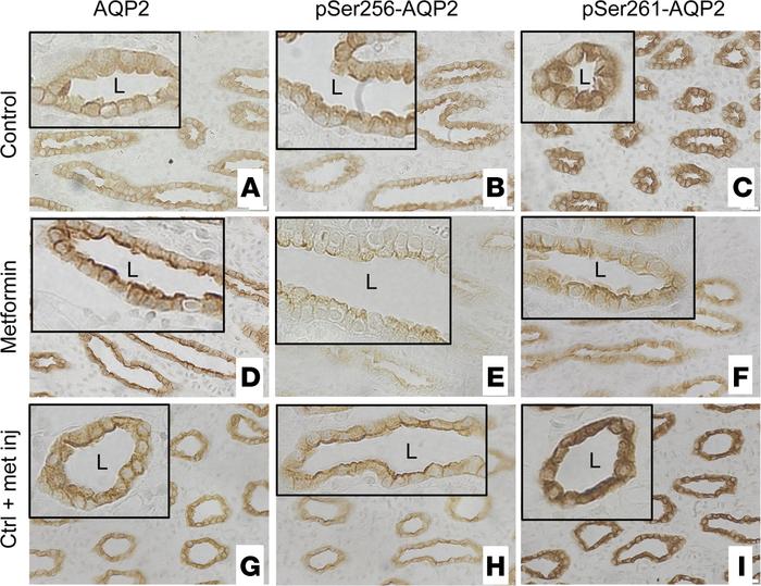 Immunohistochemical staining shows inner medullary tip collecting duct A...