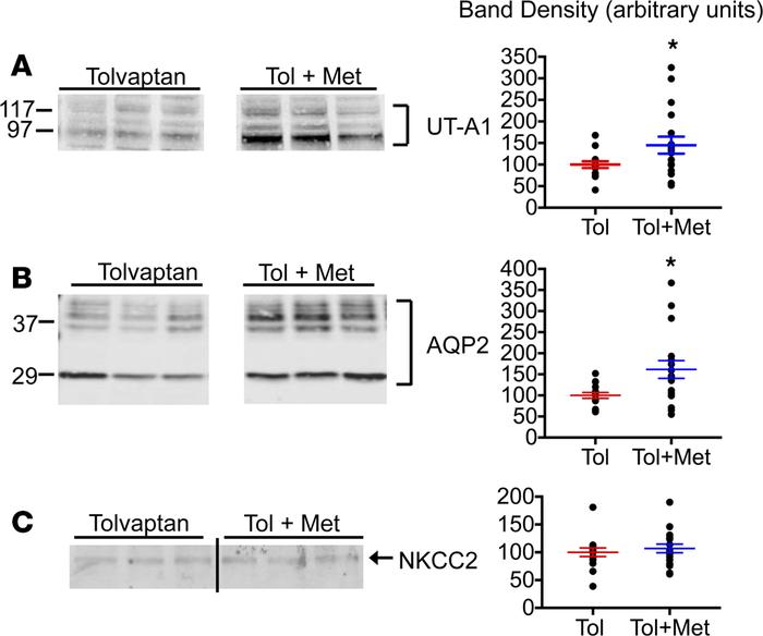 The effect of metformin on the IM tip AQP2, UT-A1, and OM NKCC2 abundanc...