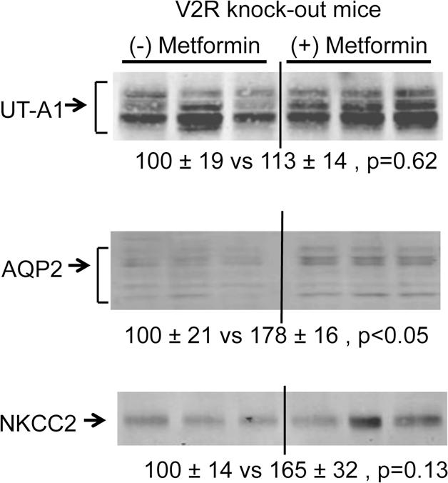 The effect of metformin on the IM AQP2, UT-A1, and OM NKCC2 abundances i...