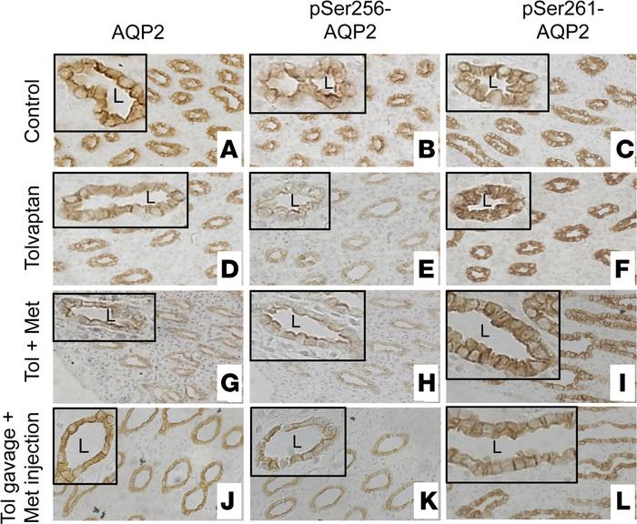 Immunohistochemical staining for AQP2, pSer256-AQP2, and pSer261-AQP2 in...