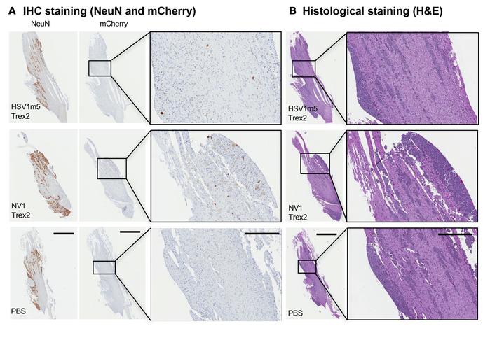 IHC and histological staining of TG from mice exposed to HSV-specific HE...