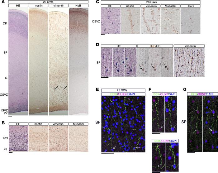 Analyses of neocortical development in human infants.
(A) Sections from ...