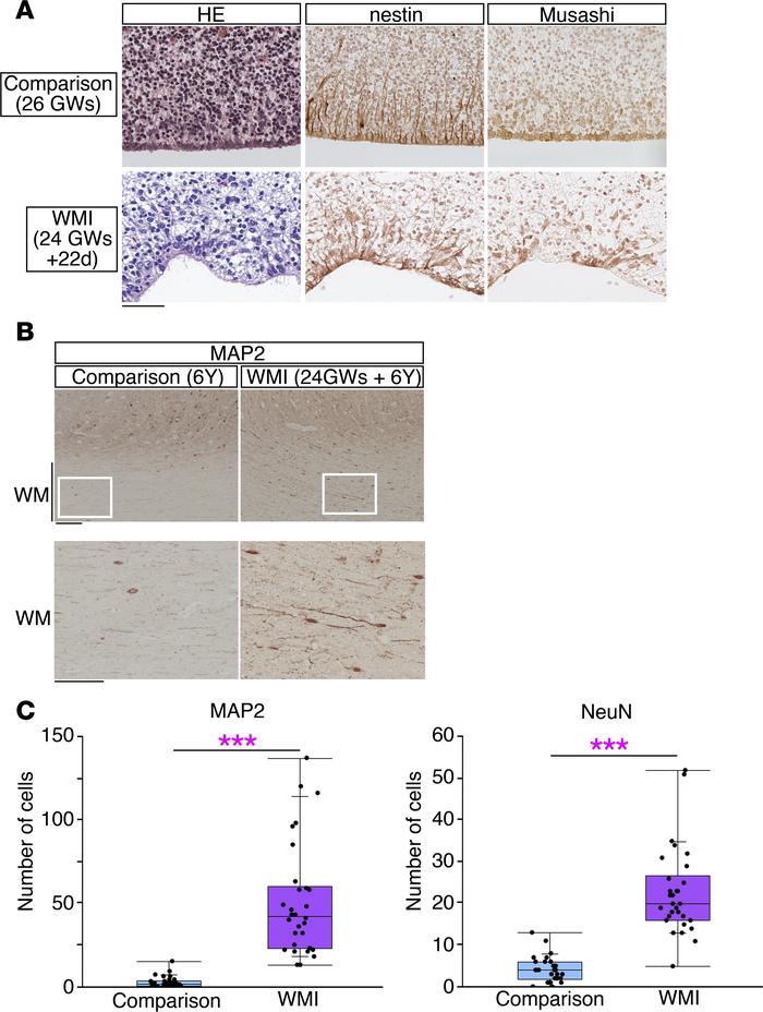Histological analyses of neocortices from extremely preterm infants.
(A)...