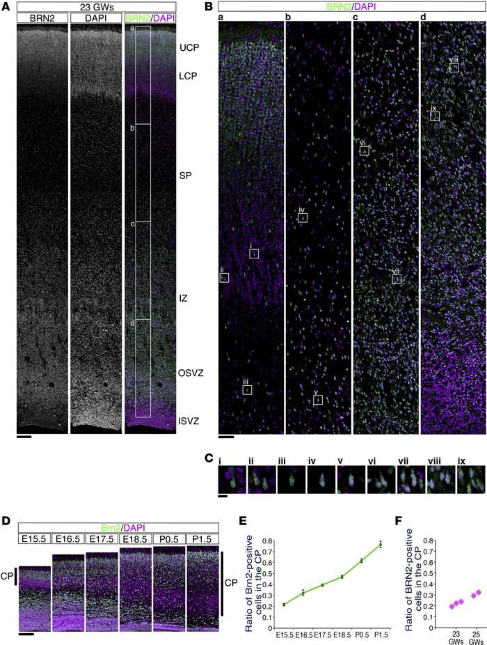 BRN2-positive cells were abundantly distributed in the subplate and inte...
