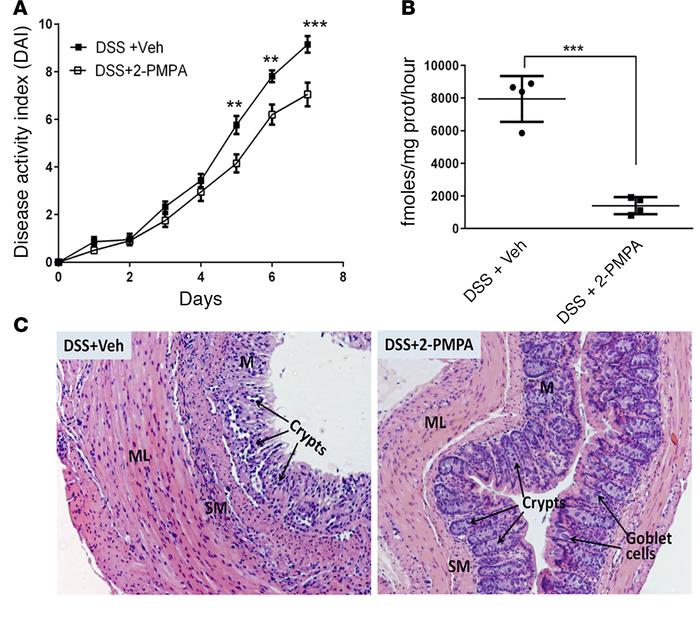 2-PMPA ameliorates dextran sodium sulfate–induced colitis.
(A) Daily 2-P...