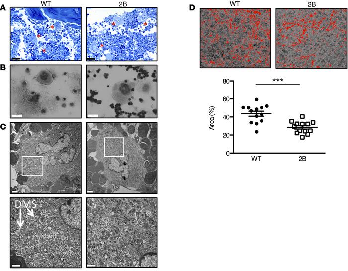 Type 2B mutant vWF/p.V1316M (2B) mice display abnormal megakaryocyte mor...