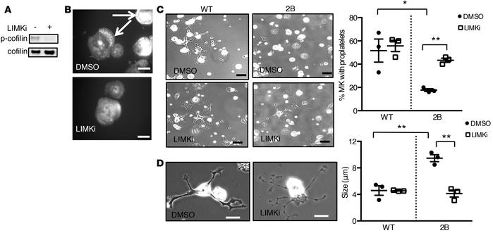 Inhibition of LIM kinase (LIMK) rescues proplatelet formation in type 2B...