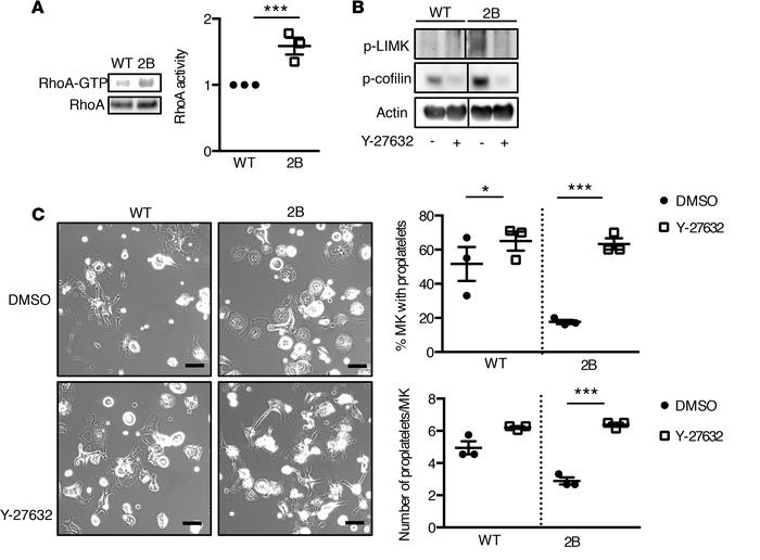 Active RhoA is upregulated in type 2B mutant vWF/p.V1316M (2B) megakaryo...