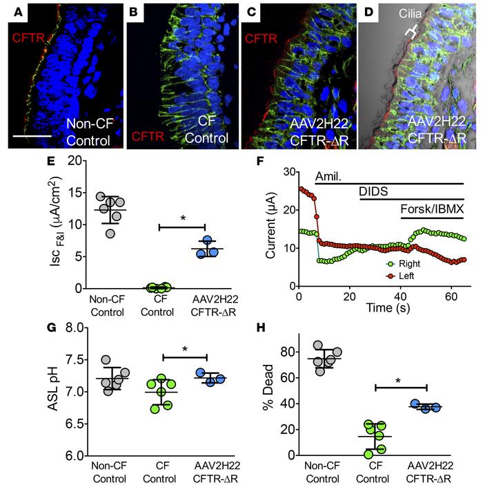 AAV2H22-CFTRΔR transduces pig airway epithelia in vivo.
(A–G) Gut-correc...