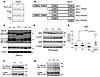 A de novo heterozygous nonsense mutation in PIK3R1 in a patient with severe