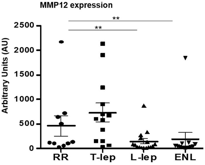 
MMP12 regulation in leprosy.
Distribution of MMP12 mRNA by microarray a...