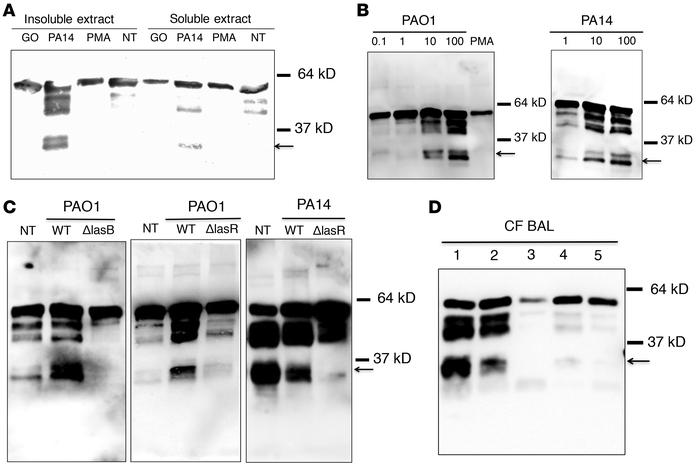 BPI is cleaved in a P.

aeruginosastrain-dependent manner. (A) Healthy n...