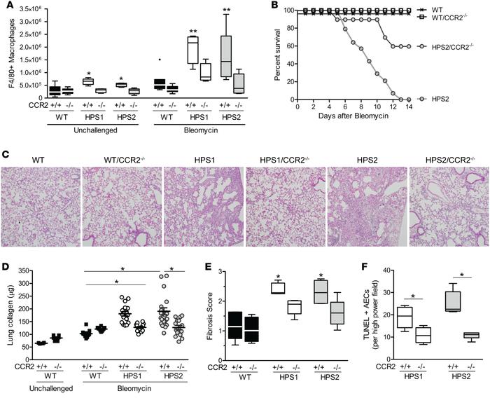 CCR2 regulates increased recruitment of macrophages and exaggerated fibr...