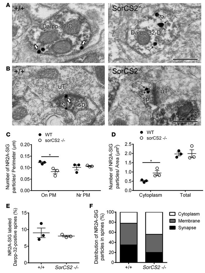 NR2A density on plasma membrane (PM) and synapses of Darpp-32–labeled MS...