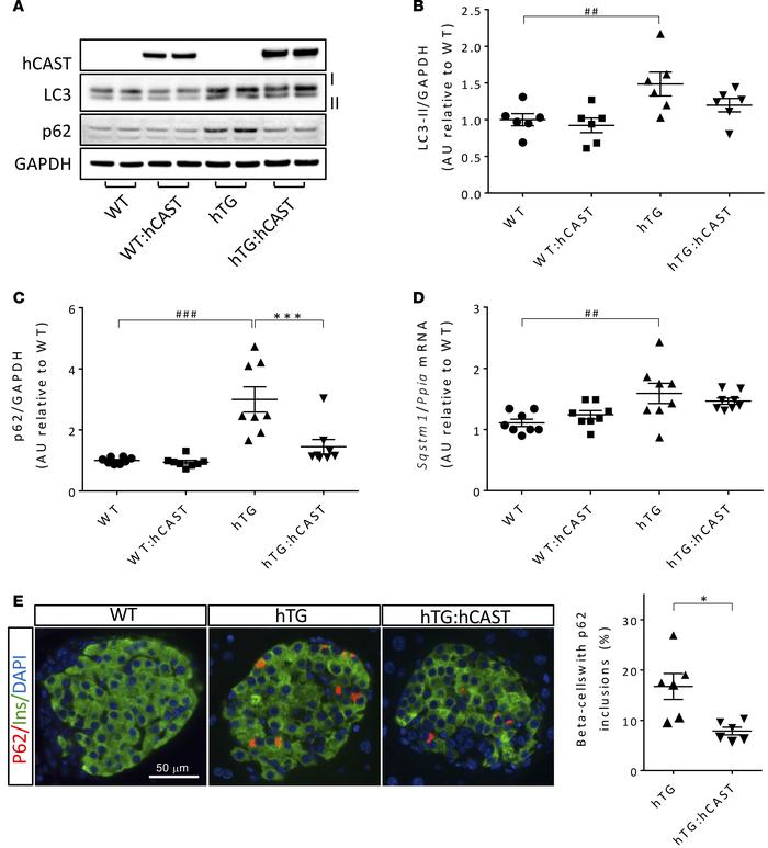 The defect in the autophagy/lysosomal pathway in β cells from hTG mice i...