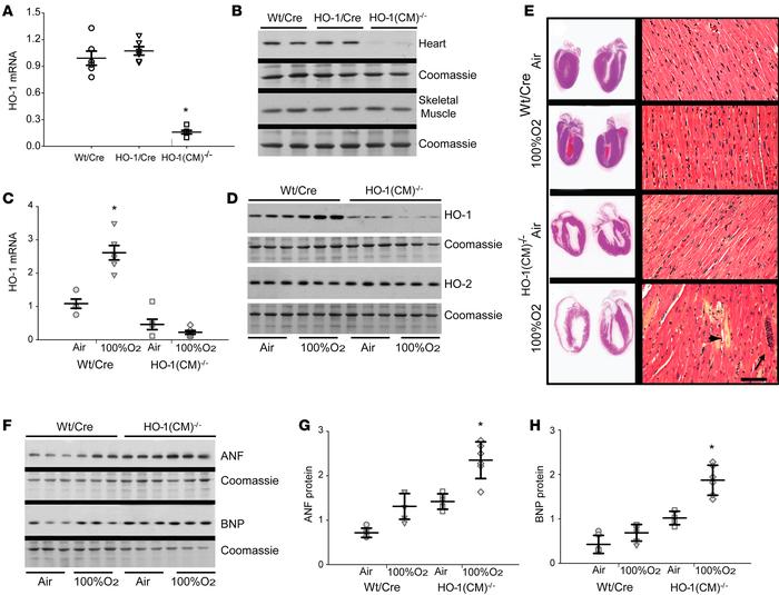 Cardiomyocyte-specific ablation of HO-1 and responses to transient hyper...