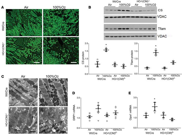 Mitochondrial density and structure in mouse heart after hyperoxia.
(A) ...