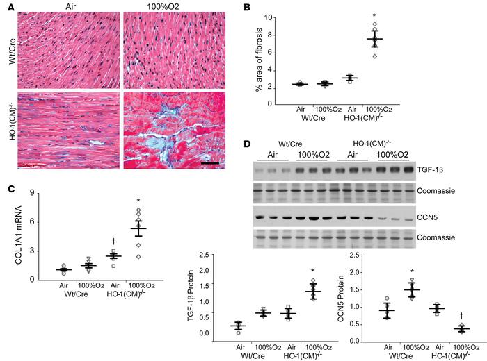 HO-1 deletion enhanced cardiac fibrosis after hyperoxia.
(A) Heart secti...