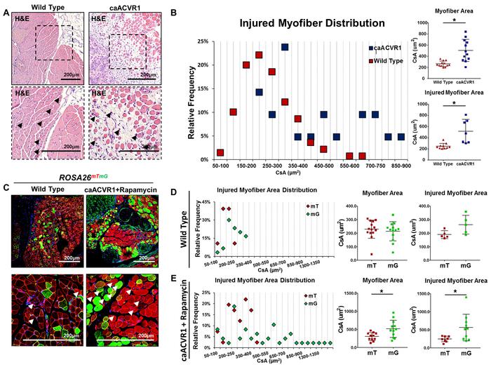 Rapamycin after injury reveals improved myofiber size with hyperactive B...