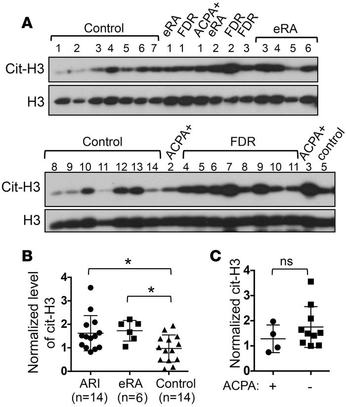 Hypercitrullination in PBMCs from healthy at-risk individuals recruited ...