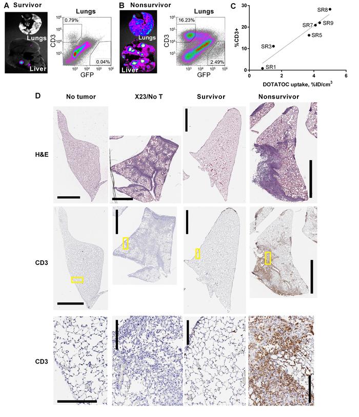 Ex vivo analysis of CAR T cell and tumor density in lungs.
Ex vivo, GFP+...