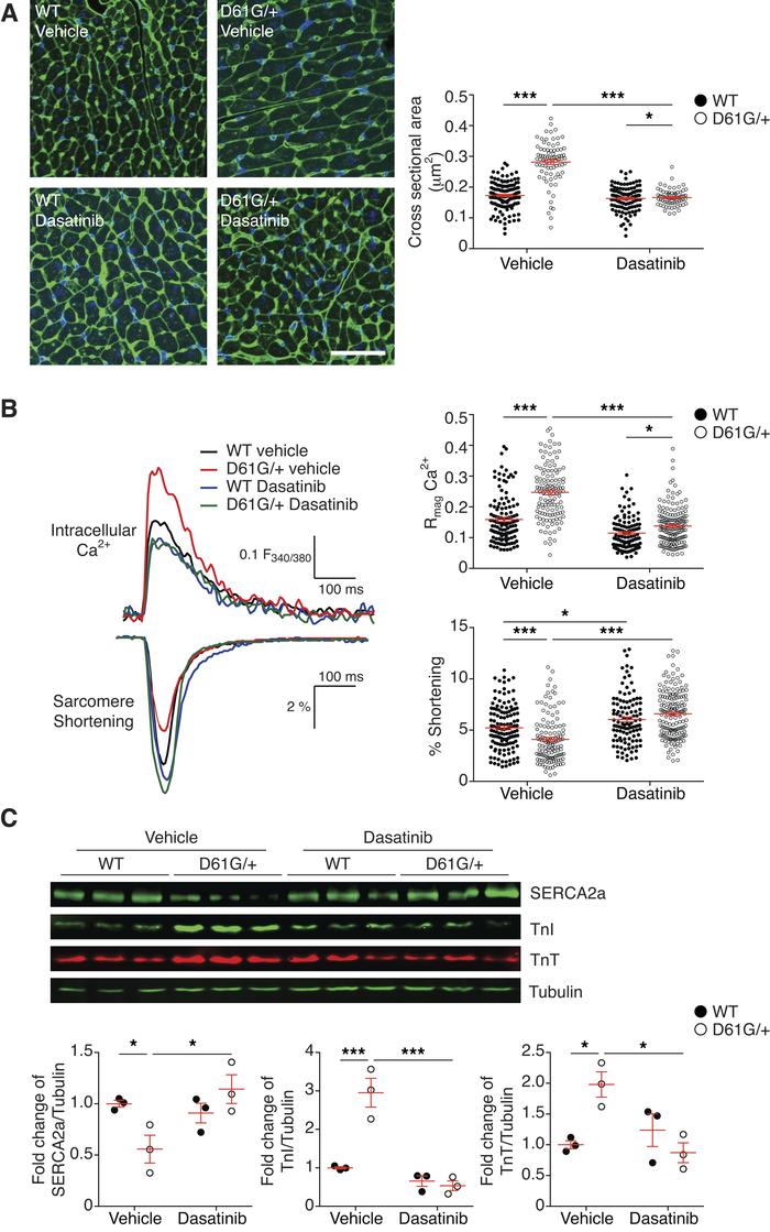 Dasatinib reverses impaired Ca2+-contraction coupling in NS cardiomyocyt...