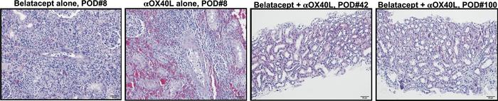 Combined costimulation blockade and OX40L blockade preserves histology o...