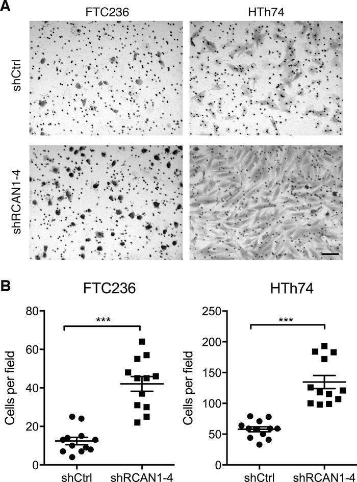 RCAN1-4 knockdown promotes cancer cell invasion in vitro.

(A) shCtrl an...