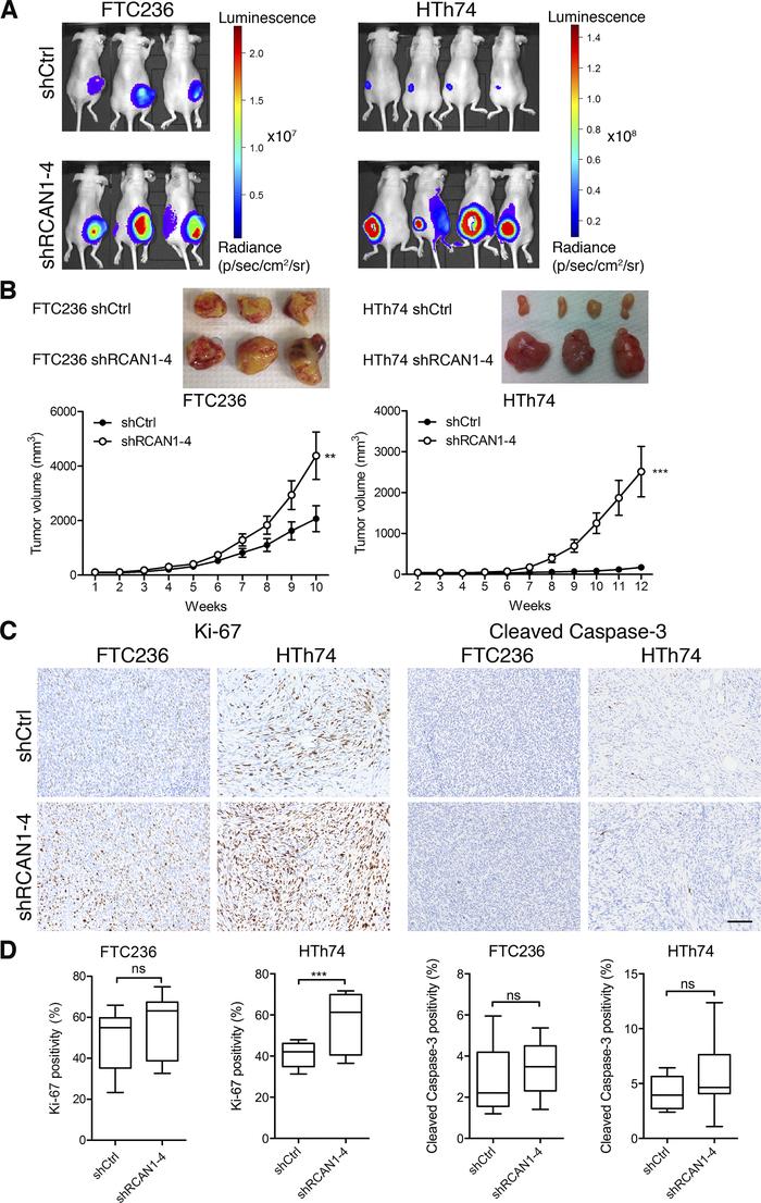 RCAN1-4 knockdown promotes tumor growth in vivo.
(A) shCtrl and shRCAN1-...