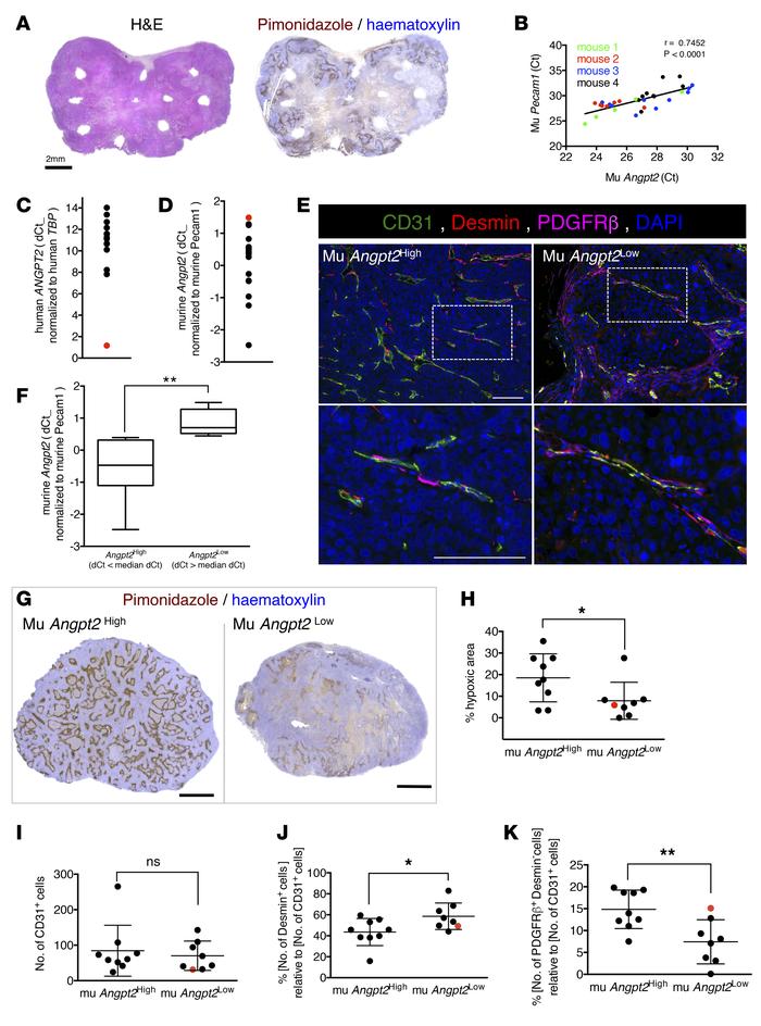 Cancer cell influence on Ang2 expression levels defines vascular integri...