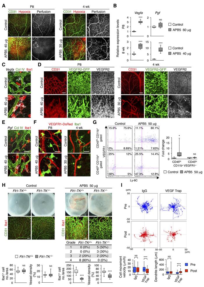 Endothelial cell–macrophage interactions via VEGF and placental growth f...