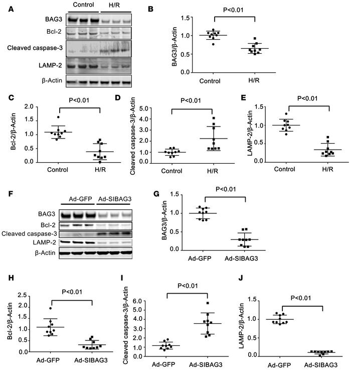 BAG3 reduction by hypoxia/reoxygenation or siRNA decreases autophagy but...