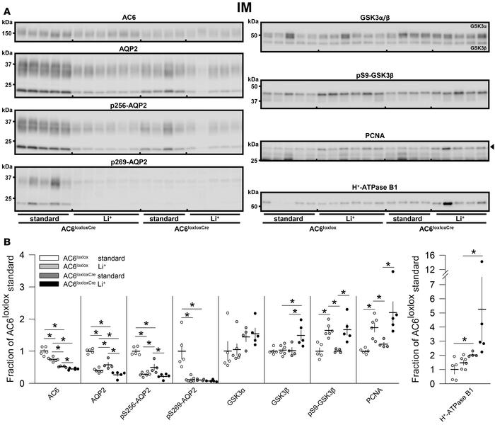 Li+ reduces inner medullary AQP2 and pS256-AQP2 abundances in AC6loxloxC...