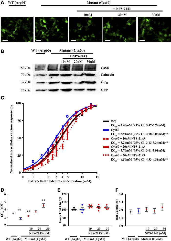 GNA11R6OC mutant increases Ca2+i responses, which can be normalized by t...