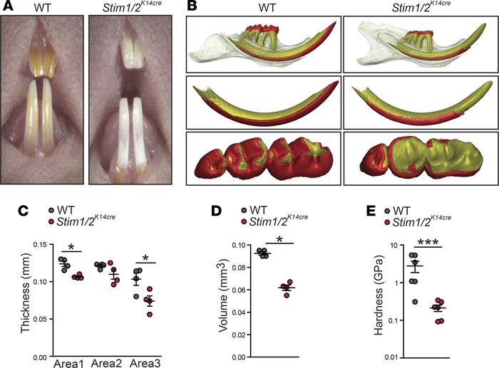 
Stim1/2K14cre mice show abnormal enamel.
(A) Gross examination of the d...